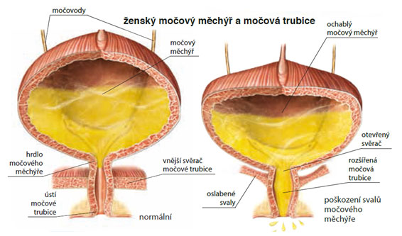 Schema: močový měchýř